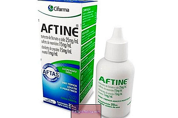 Aftine : 정의, 용도 및 사용 방법