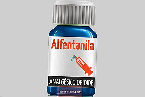 Alfentanila Opioidní analgetický lék