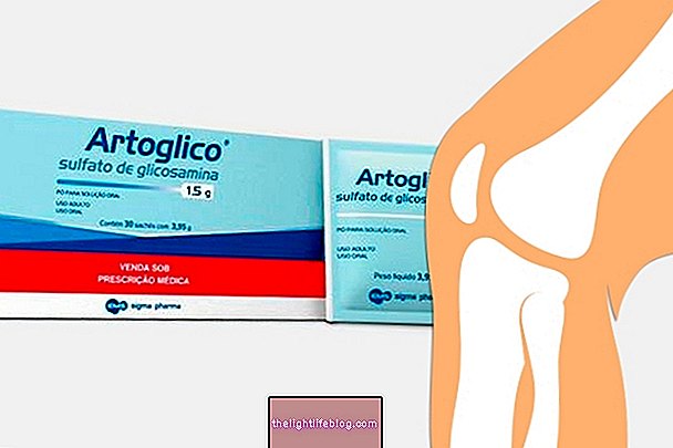 Artoglico για προβλήματα αρθρώσεων