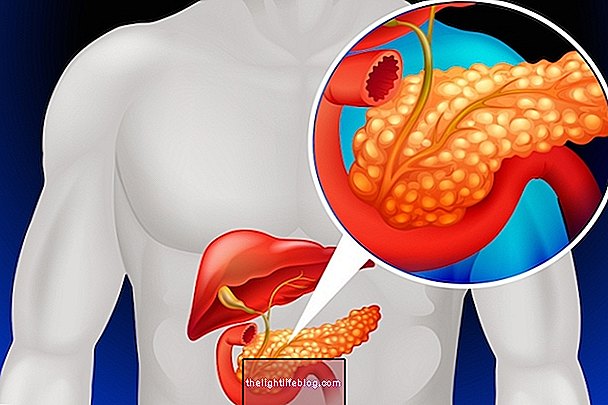 Cấy ghép tuyến tụy được thực hiện như thế nào và khi nào thì thực hiện