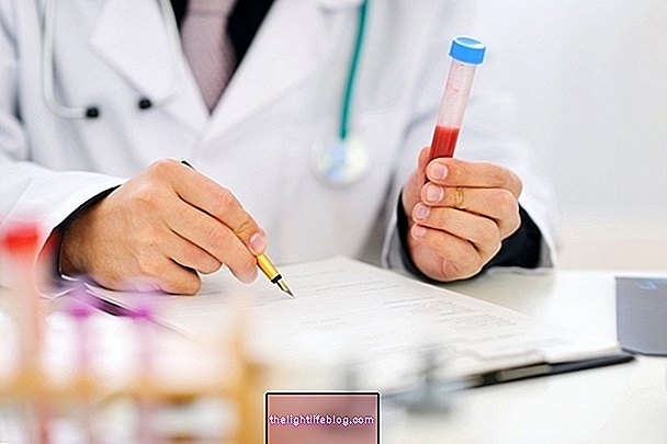 Creatinine cao: 5 nguyên nhân chính, các triệu chứng và những gì cần làm