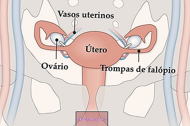 자궁 이식 : 그것이 무엇인지, 어떻게 이루어지며 가능한 위험