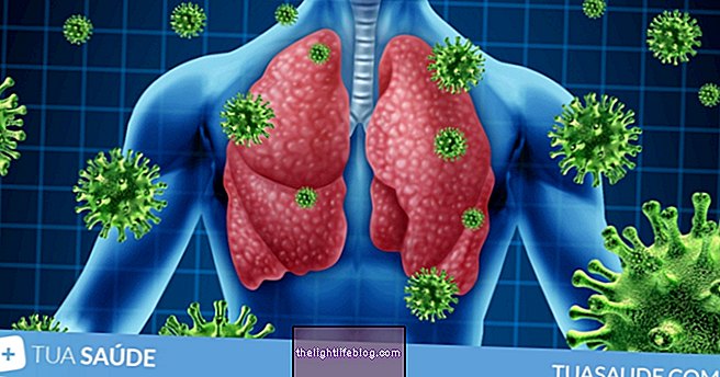 Hvordan er behandlingen af ​​coronavirus (COVID-19)