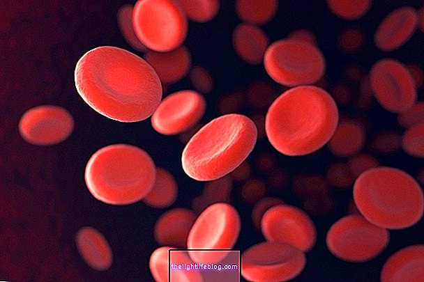 Anemia mikrositik: apa itu, jenis dan rawatan utama