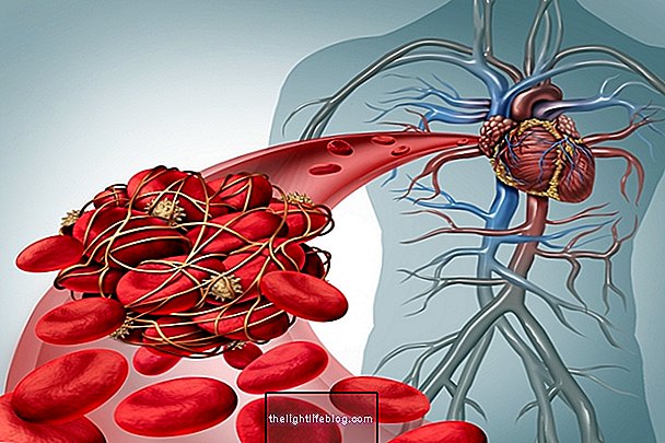 Dickes Blut: Was es ist, Symptome und wie ist die Behandlung