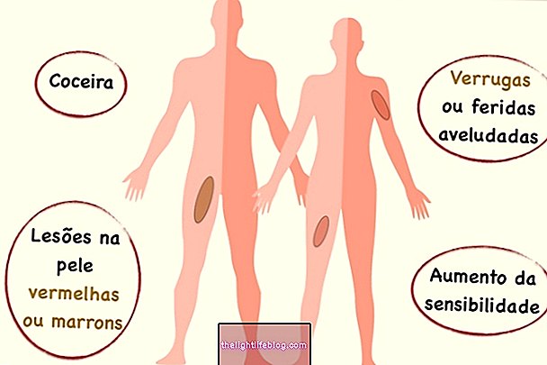 Verrucous Nevus 치료