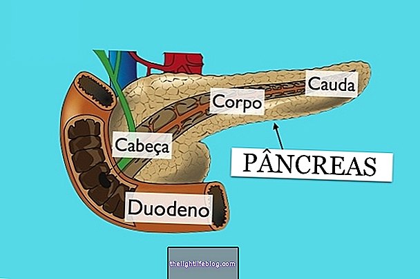 Pancreatic Cancer Surgery