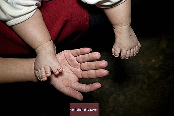 Apa itu polydactyly, kemungkinan penyebab dan rawatan