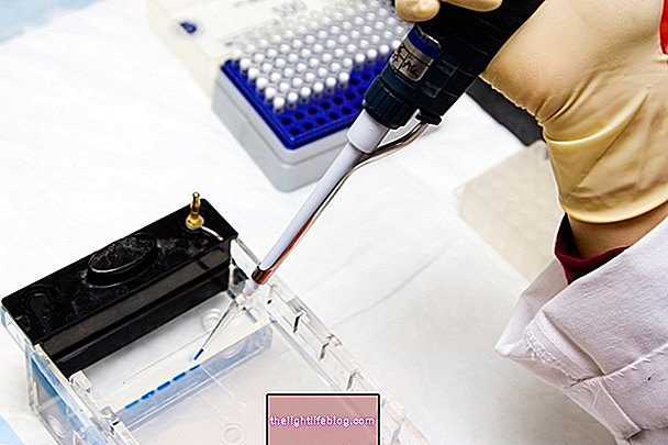 Electrophoresis: what it is, what it is for and how it is done