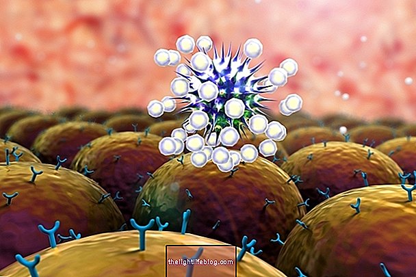 風疹IgG：それは何であり、結果を理解する方法