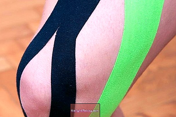 Kinesio tape คืออะไรมีไว้ทำอะไรและใช้อย่างไร