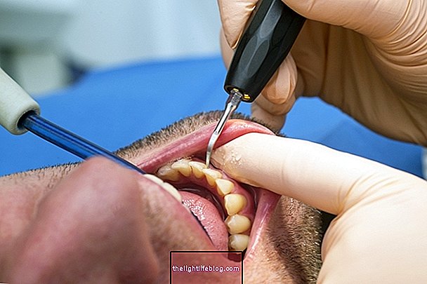 Periodontitis tedavisi nasıl