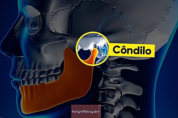 كيفية التعرف على الفك النازح وعلاجه