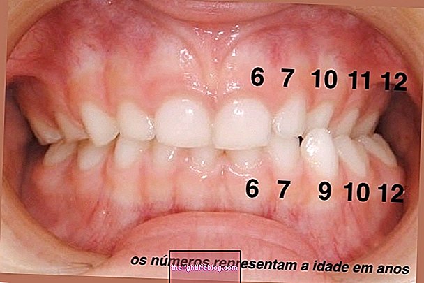 Bir dişin doğması ne kadar sürer (ve eğer sürerse ne yapmalı)