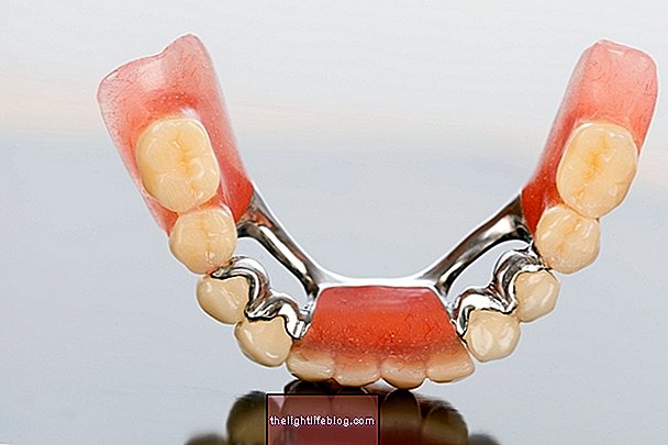 Types of dental prosthesis and how to care