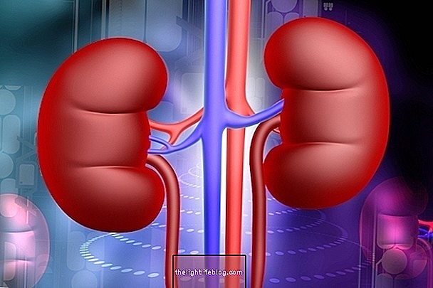 Vesikoureteraler Reflux: Was es ist, Grad, wie zu identifizieren und zu behandeln