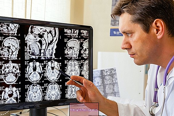 Ataxia คืออะไรสาเหตุอาการและการรักษา