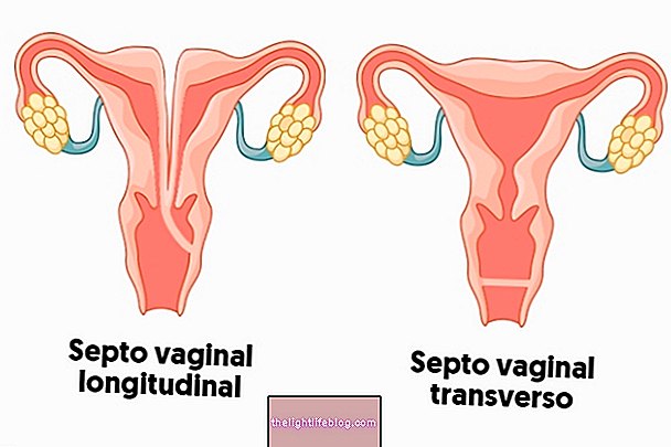 Apakah septum faraj dan bagaimana merawatnya