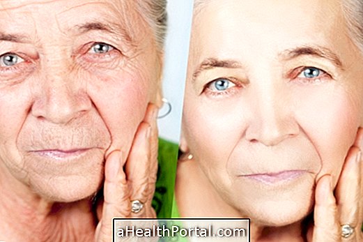 Cosmetic surgery to have a younger face without wrinkles