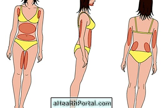 When to do a liposuction