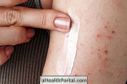 Tarfic: mast za atopijski dermatitis