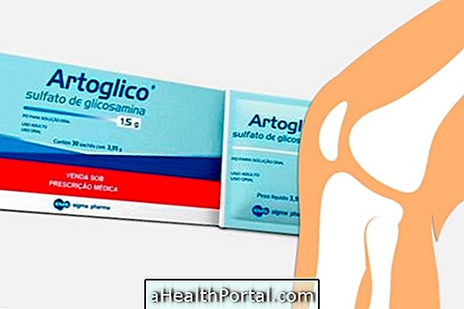 संयुक्त समस्याओं के लिए Artoglico