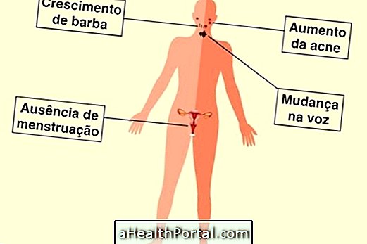 どのように女性のテストステロンを特定し、低下させる