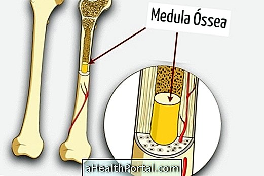 Trapianto di midollo osseo: che cosa è e possibili rischi e complicanze