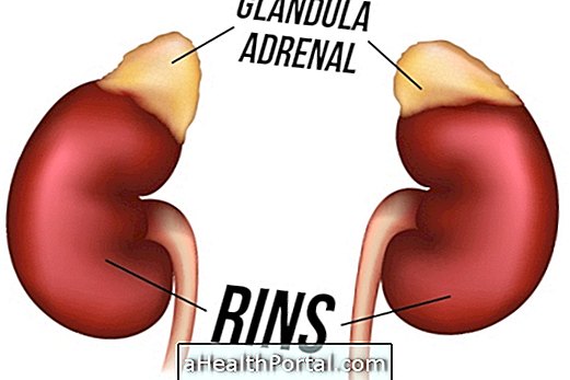 Apakah Keletihan Adrenal dan Bagaimana Memperlakukannya