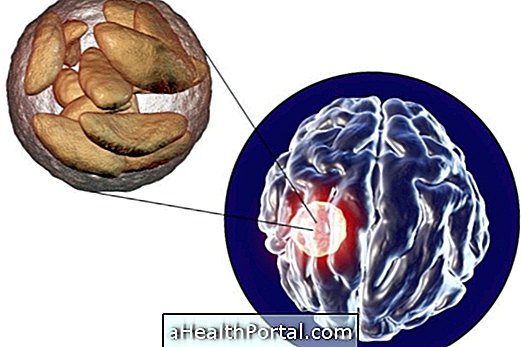 Hvad er Brain Abscess og hvordan man kan identificere