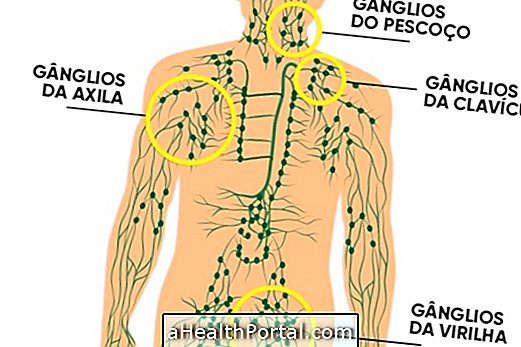 Was ist die Funktion der Lymphknoten und woher kommen sie?