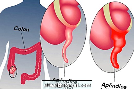 ภาคผนวกคืออะไรและสำหรับอะไร