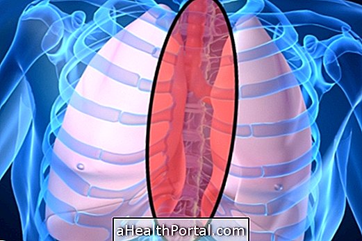 Mediastinal cancer