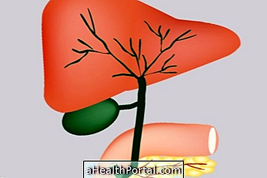 प्राथमिक बिलीरी कोलांगिटिस: लक्षण, निदान और उपचार