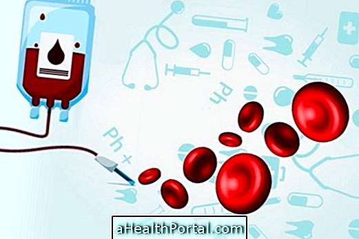 Thalassemia के लिए उपचार