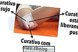 手術後速やかに回復するために何をすべきか