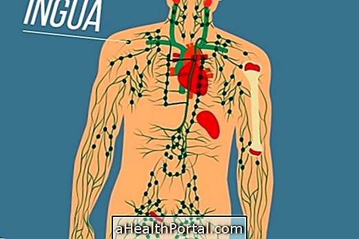 Apa Yang Bengkak Lymph Nod Mean dan Apabila Mungkin Menjadi Kanser