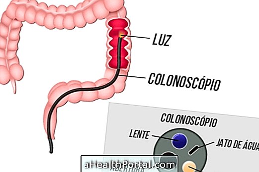 อาหารเพื่อเตรียมสำหรับ colonoscopy