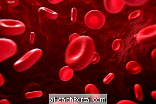 Pancytopenia 란 무엇이며 그 원인은 무엇입니까?