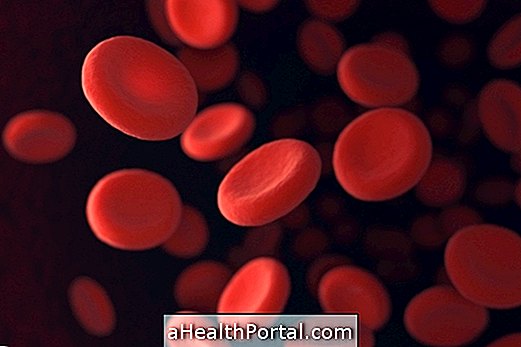 Anemia perniciosa: sintomi, diagnosi e trattamento