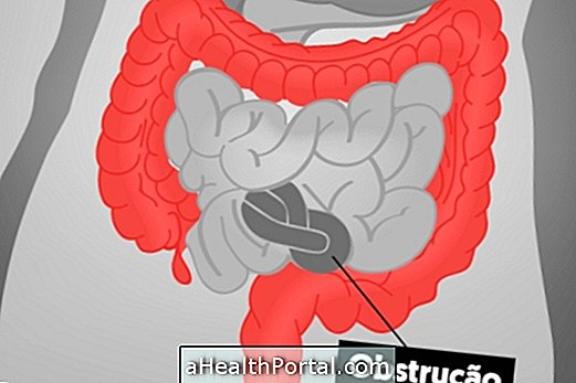 What is Bowel Obstruction and How to Treat It