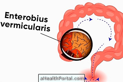 Ce trebuie să faceți pentru a preveni enterobioza și cum să o tratați