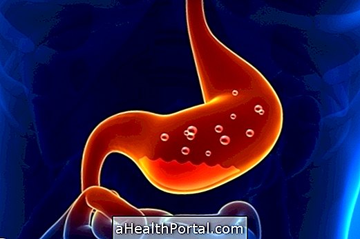 Che cos'è la dispepsia e come migliorare la digestione degli alimenti