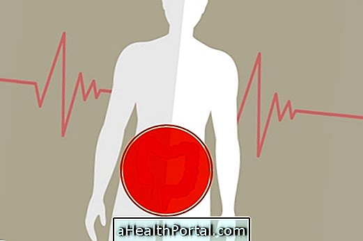 Crohn Hastalığı: Bu Kötülük Hakkında Daha Fazla Bilgi Edinin (Komple Kılavuz)