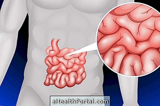 How bowel transplantation is done