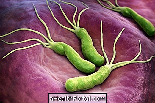 How to get and how to treat H. pylori bacteria