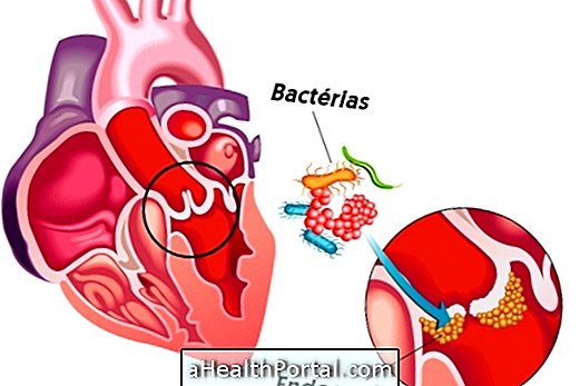 Trattamento per endocardite batterica