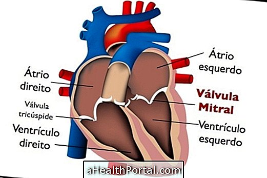 Understand Mitral Failure