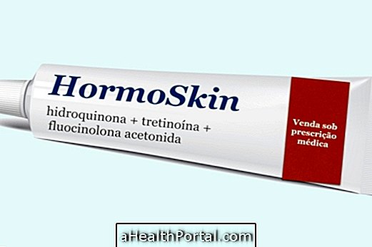 How to use the Hormoskin whitening cream for melasma