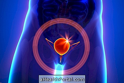 Come identificare e curare il cancro alla vescica